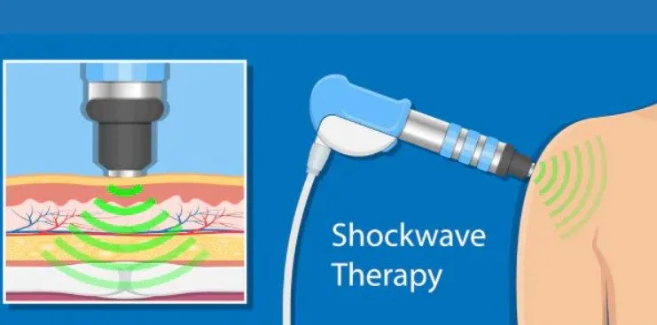 Therapist using shockwave therapy machine on patient's wrist